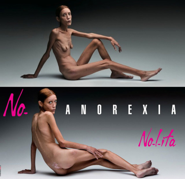 anoreksja 4